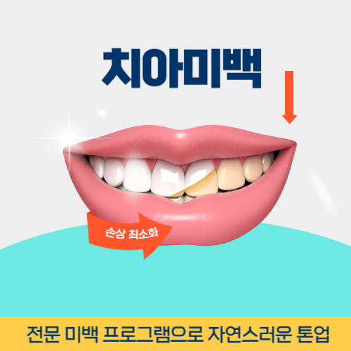 의정부치과 의정부시 치과 치아미백
